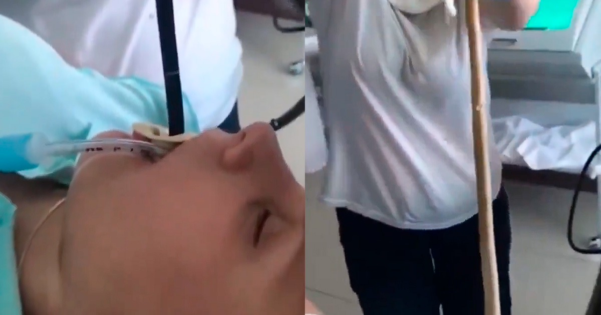 Mulher sente uma azia muito forte, vai ao médico, fazem uma endoscopia e retiram um verme de 35 cm